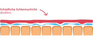 Darmwand mit schädlichen Biofilm 