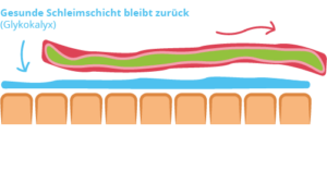 Der Biofilm wird sanft von der Darmwand gelöst und ausgeschieden. Zurück bleibt die freigelegte Darmschleimhaut.