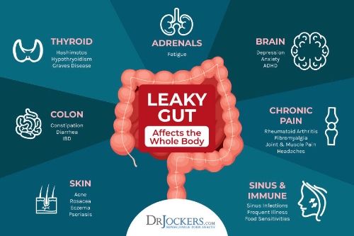 Leaky Gut beeinflusst den gesamten Körper: Infografik, die den Einfluss des Darms auf Hormone, Gehirn, Knochen & Gelenke, Haut, Verdauung und Schilddrüse aufzeigt